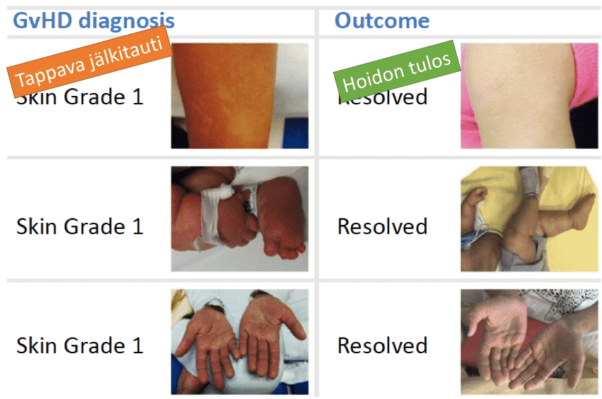 Käänteishyljintätauti on merkittävä riskitekijä haploidenttisissä kantasolusiirroissa. Bellicumin kehittämä itsemurhakytkin saattaa mahdollistaa entistä paremmat hoidot tulevaisuudessa. 