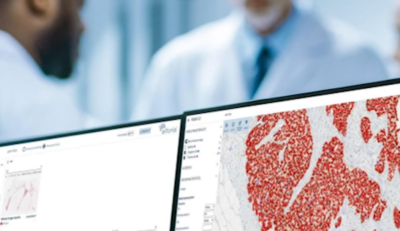 Aifonia osake tekoäly patologia