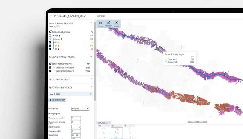 Aiforia tekoäly kuva-analyysi ohjelmisto