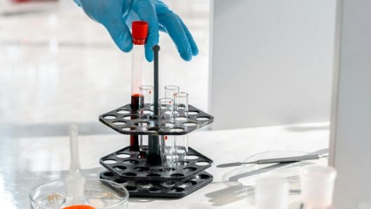 laboratorio verinäyte