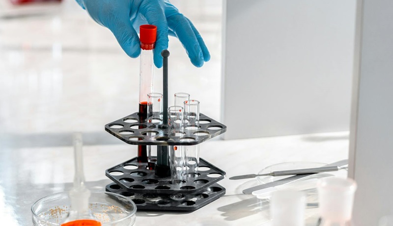 laboratorio verinäyte