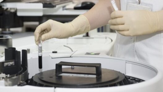 BioInvent International