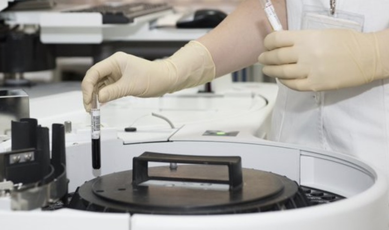 BioInvent International